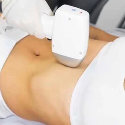Stomach Line Laser - 5 sessions at Blessed & Bare Laser Studio in New York, NY